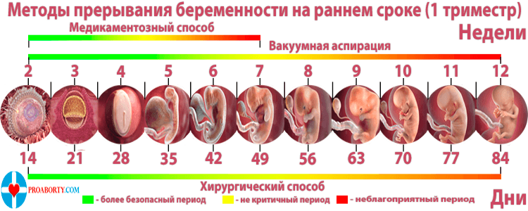 Прерывание беременности на ранних сроках - таблица